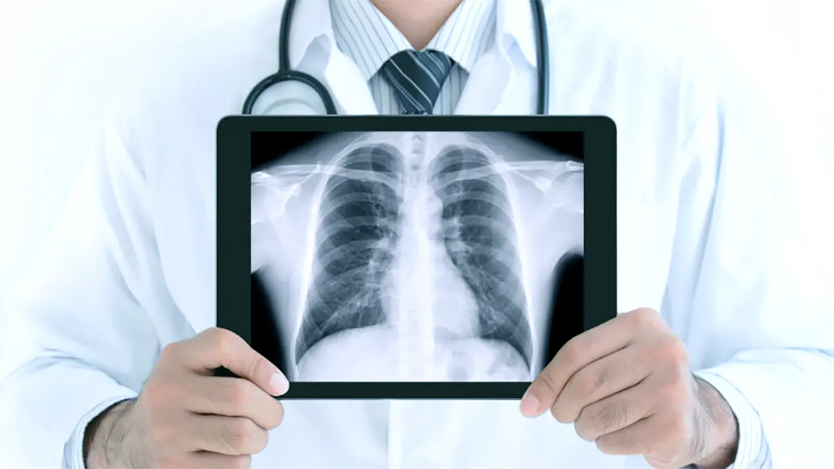 X-Ray